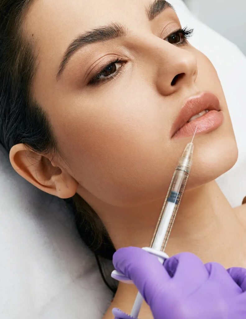 Lips dermal fillers